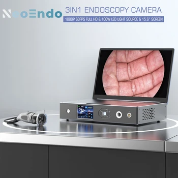 Эндоскопическая Камера 3 В 1 Full HD 1080P 60 кадров В секунду Со Светодиодным Источником света Мощностью 100 Вт И Экраном 15,6 дюйма Портативная Медицинская Эндоскопическая Камера